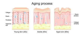 File:Aging skin.jpg